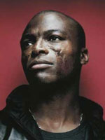 Celebrities with Lupus: Seal
